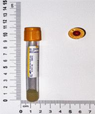 http://web.cmuh.cmu.edu.tw/HTML/dept/1t24/intranet/blood%20band/563.Platelet%20antibody%20test(Indirect).files/image002.gif