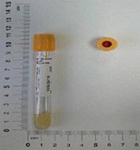 https://appointment.cmuh.org.tw/HTML/dept/1t24/intranet/chemistry/302.IgA(Immunoglobin%20A).files/image002.jpg