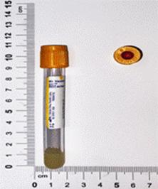 https://appointment.cmuh.org.tw/HTML/dept/1t24/intranet/serum/glycated%20albumin.files/image002.gif